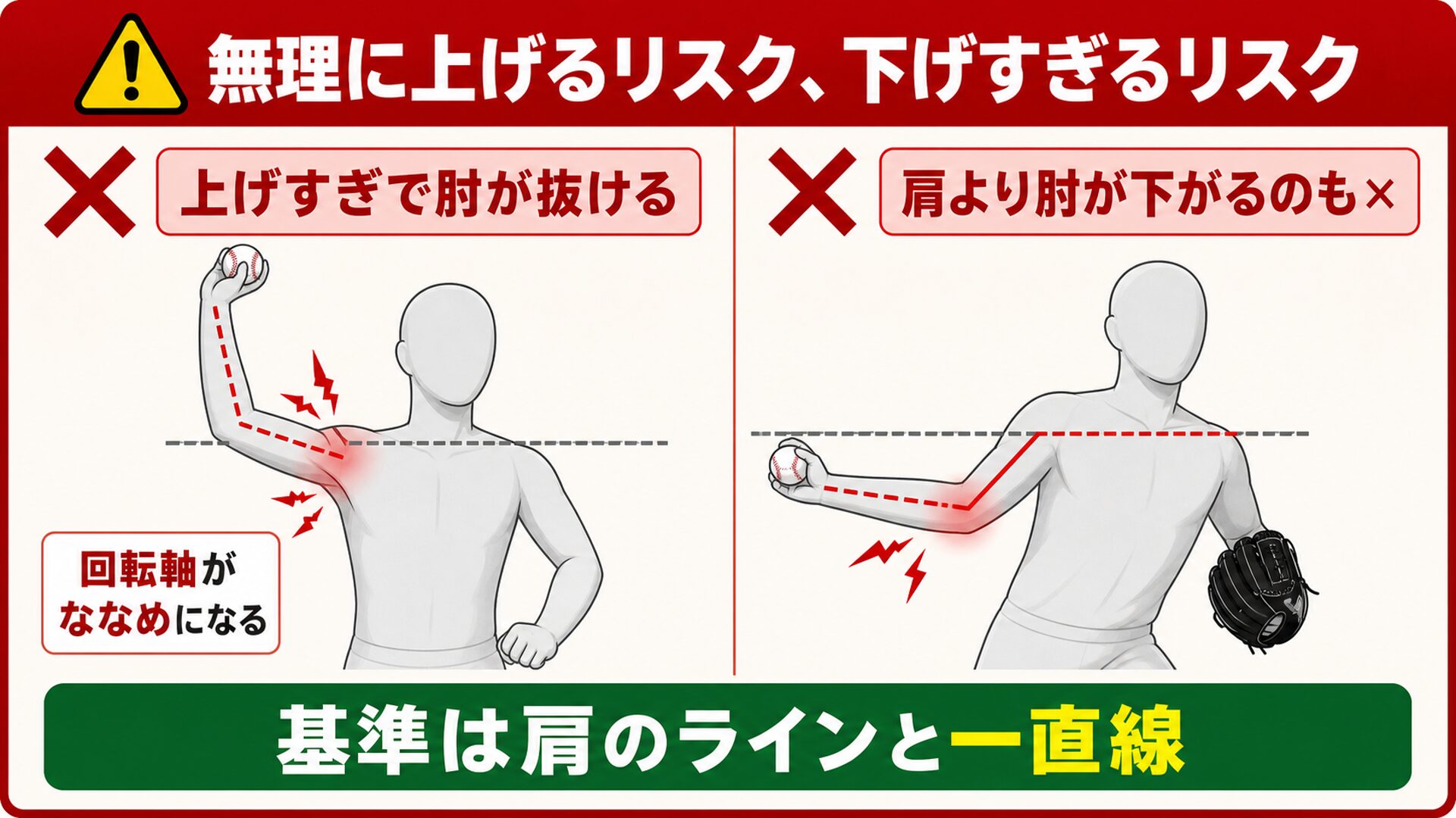 腕を上げすぎるリスクと肘が下がるリスクの図解