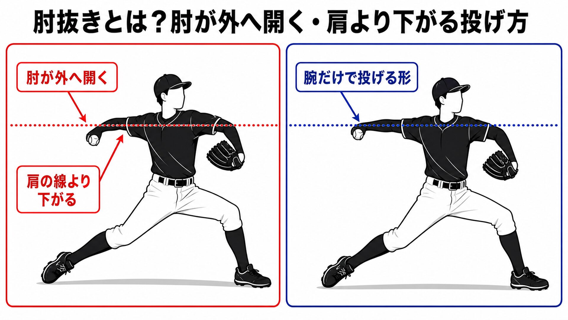 肘抜きとは？肘が外へ開く・肩より下がる投げ方の図解