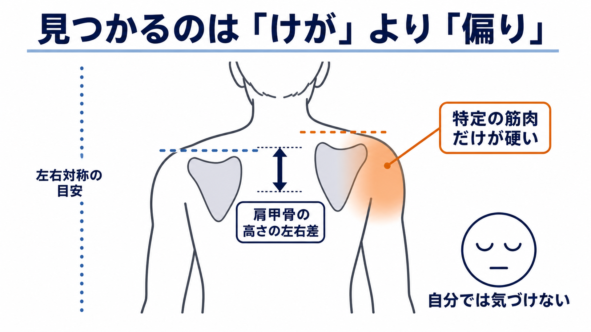 見つかるのは「けが」より「偏り」