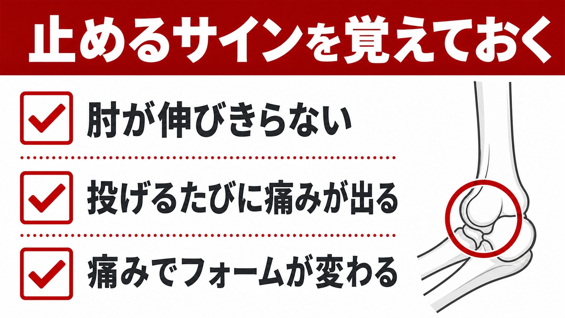 止めるサインを覚えておく